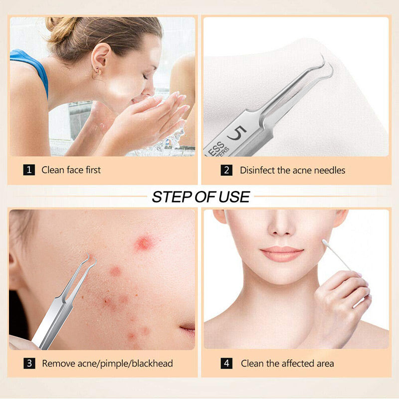 🔥🔥Befristeter Sonderpreis ✨ 3 für 5 Aktion – ab 5,99 €/Set! Kürzlich 10.000 Einheiten verkauft ~🌟🌟Spezialisierte Pinzetten für Schönheitssalons