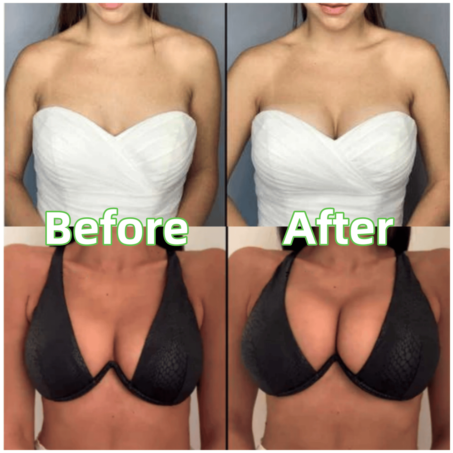 💕NUR HEUTE IM ANGEBOT: NUR 8,33 €!!💕OUFALI Lift-Einlagen für BHs – Leicht gepolstert, doppelseitig klebend👙 Wiederverwendbar, waschbar • Natürlicher Lift • Nahtlos unter der Kleidung ✨
