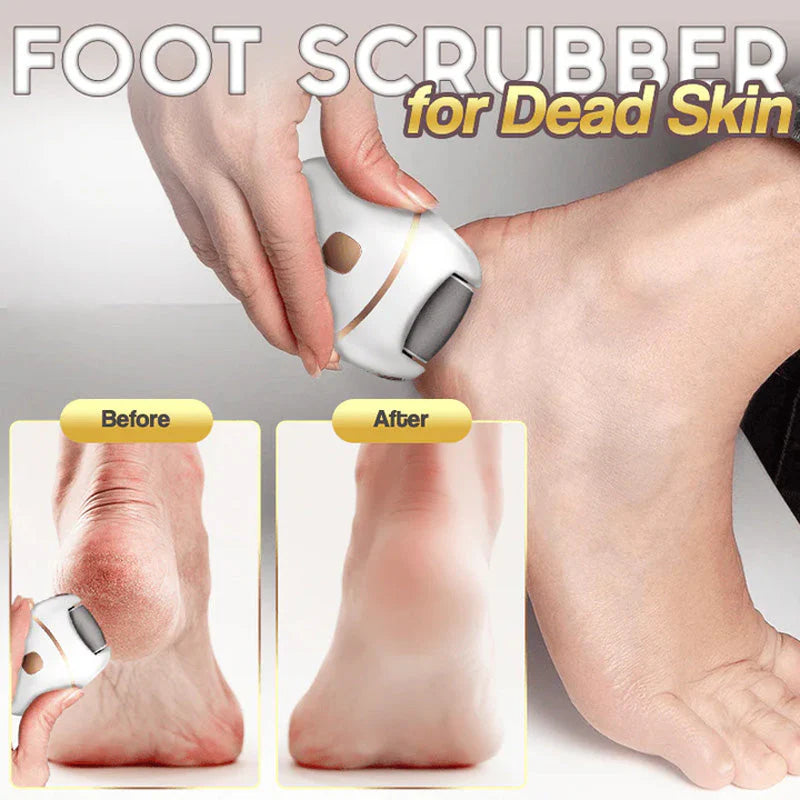 🔥HEISSER VERKAUF 50% RABATT🔥 Wiederaufladbarer elektrischer Fußpeeling-Schrubber