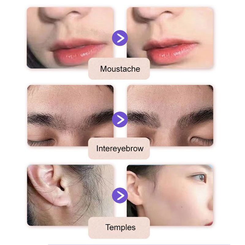 📢📢 2+1 GRATIS!! 🌸🌸Sanfte Haarentfernungscreme für Körper & Gesicht