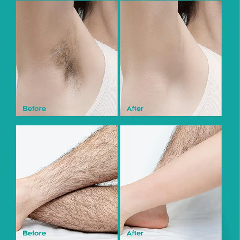 📢📢50 % Rabatt!! ⏰🔥Schmerzfreie Ganzkörper-Haarentfernungscreme für Männer und Frauen – Hautfreundlich für alle Körperbereiche🌿