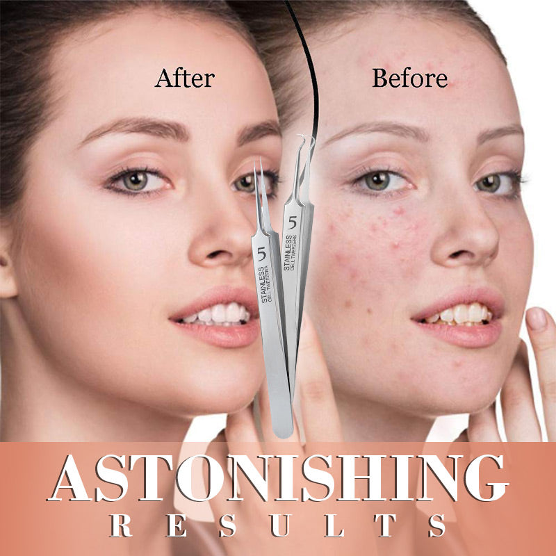 🔥🔥Befristeter Sonderpreis ✨ 3 für 5 Aktion – ab 5,99 €/Set! Kürzlich 10.000 Einheiten verkauft ~🌟🌟Spezialisierte Pinzetten für Schönheitssalons