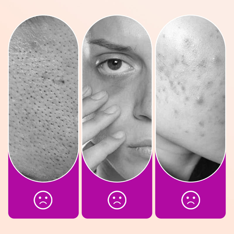 🔥KAUFEN SIE 2, ERHALTEN SIE 1 GRATIS🔥 Flawless Under Eye Concealer | Hellen Sie dunkle Ringe und Falten auf ✨ DER PROFESSIONELLE KORREKTURHELFER