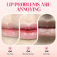 ⚡Über 50.000 verkauft!✨ Nooni Apfel‑Feuchtigkeitsspendendes Lip‑Öl – Voluminisierend, farbbeständig mit glänzendem Finish 💋