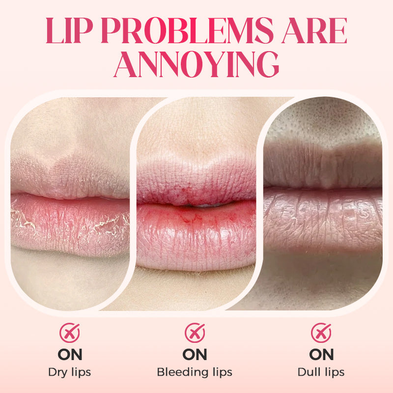 ⚡Über 50.000 verkauft!✨ Nooni Apfel‑Feuchtigkeitsspendendes Lip‑Öl – Voluminisierend, farbbeständig mit glänzendem Finish 💋