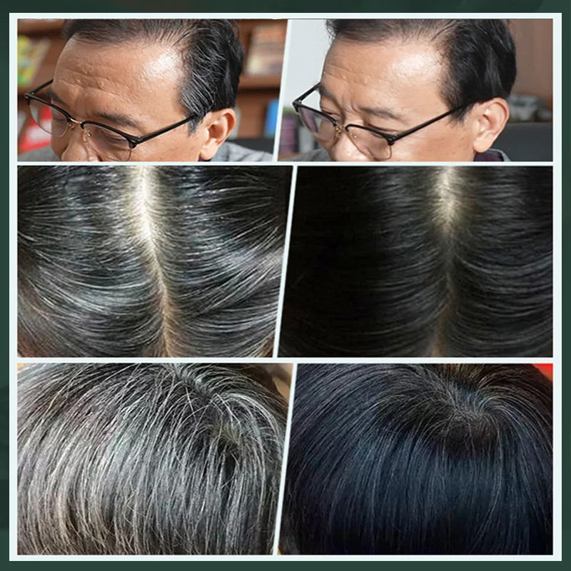 💇‍♀️ KAUFE 2, ERHALTE 1 GRATIS! ✨ Deutsche Pflanzenhaarfarbe für Salon-Perfekte Wurzeln – 100% Pflanzenkraft, Einfache Anwendung & Deckt Graues Haar In 5 Minuten 🌿
