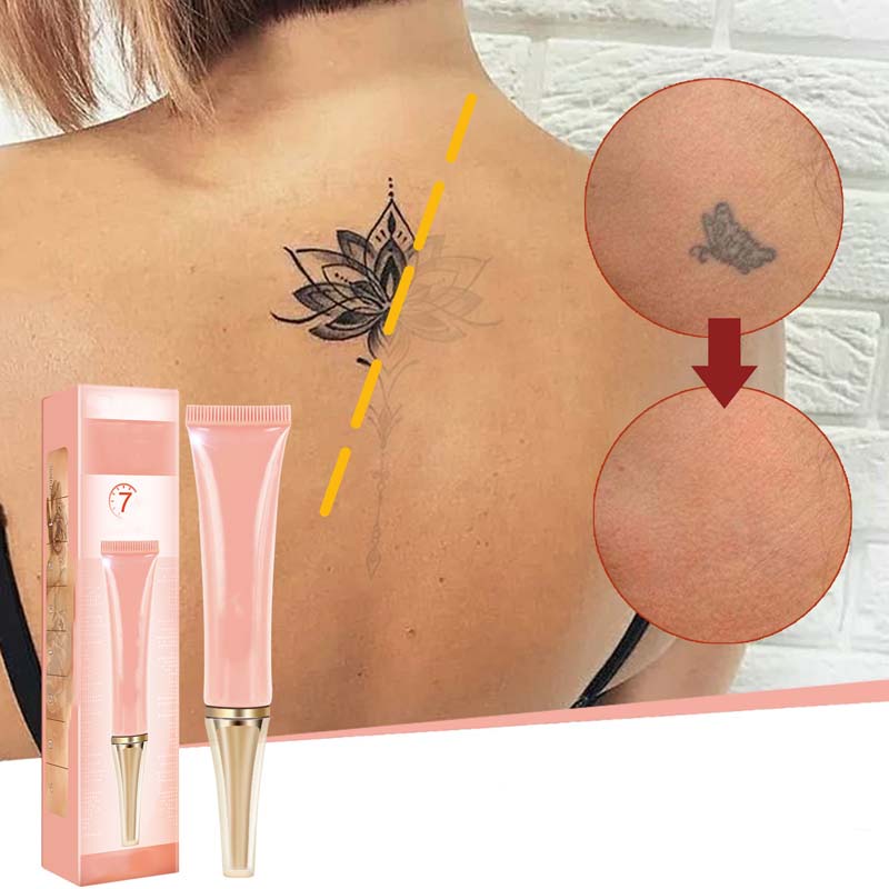 📢📢50 % Rabatt!!🥳 💞 50K+ VERKAUFT! ⚡ Sanfte, effektive Tattoo-Aufhellungscreme für vielfältige Anwendungen ✨