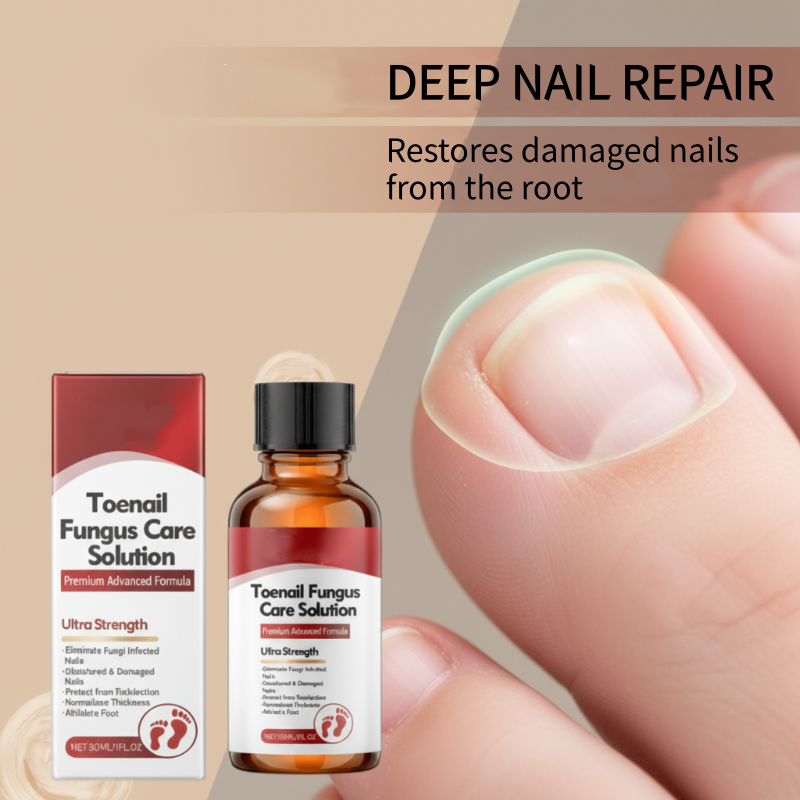 🔥50% RABATT!!!🔥 Nagel-Reparaturessenz für geschädigte Nägel