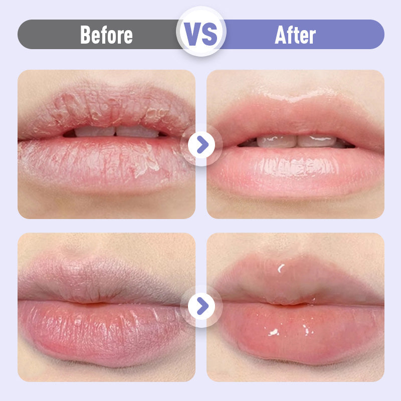 🔥🎁 2+1 GRATIS!! 💋💧 Aufpolsterndes und feuchtigkeitsspendendes Lippenserum gegen Falten✨
