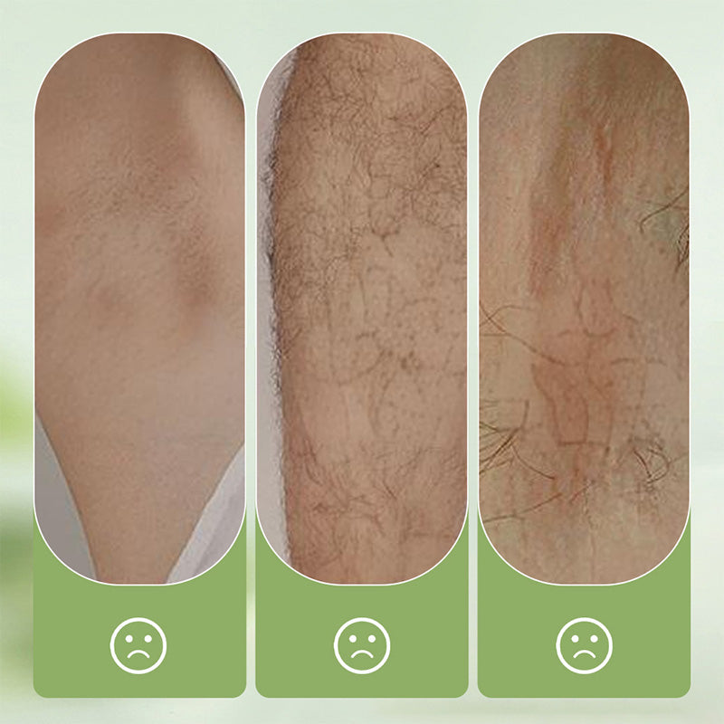 📢📢 LIMITIERT: 50% RABATT ⏰✨Sanftes und hautfreundliches Haarentfernungsset (Haarentfernungscreme + Rasierer) | Zeitlich begrenztes Angebot 🎁
