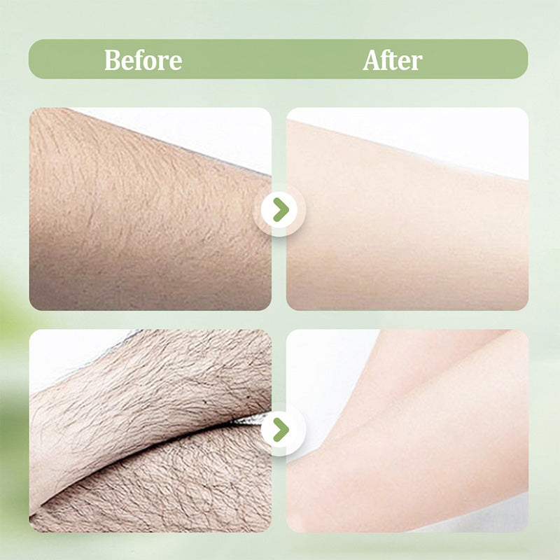 📢📢 LIMITIERT: 50% RABATT ⏰✨Sanftes und hautfreundliches Haarentfernungsset (Haarentfernungscreme + Rasierer) | Zeitlich begrenztes Angebot 🎁