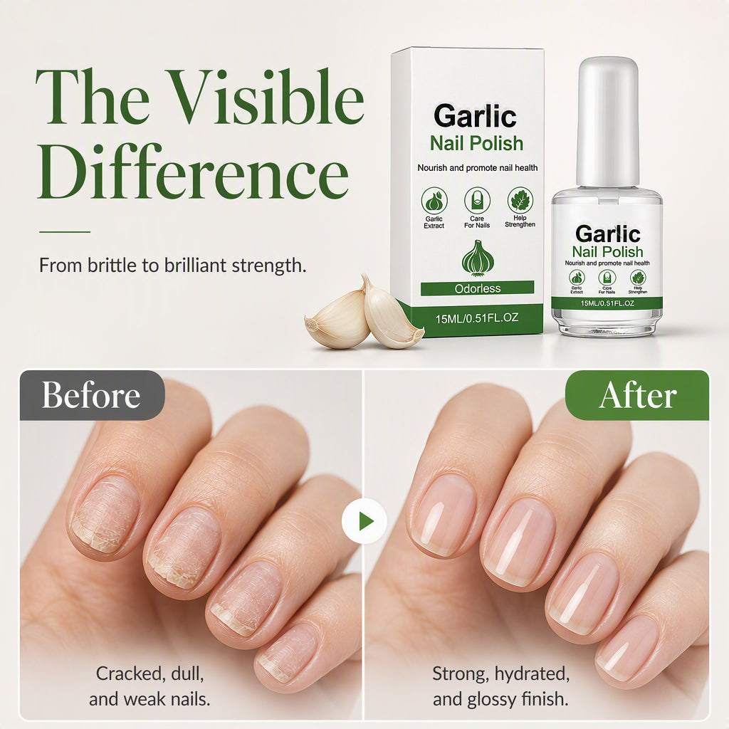 🔥 50 % RABATT 💅 Nagelstärkungsöl – hilft schwachen, brüchigen und beschädigten Nägeln, stärker auszusehen ✨
