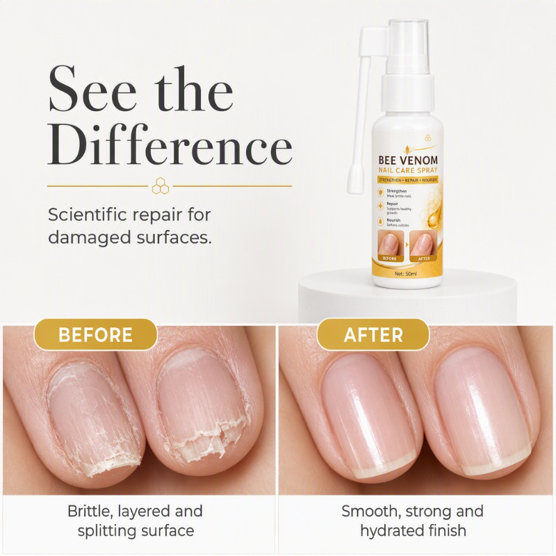 🔥🎁 1+1 GRATIS!!💅Nagelstärkungs- und Pflegespray mit Bienengift