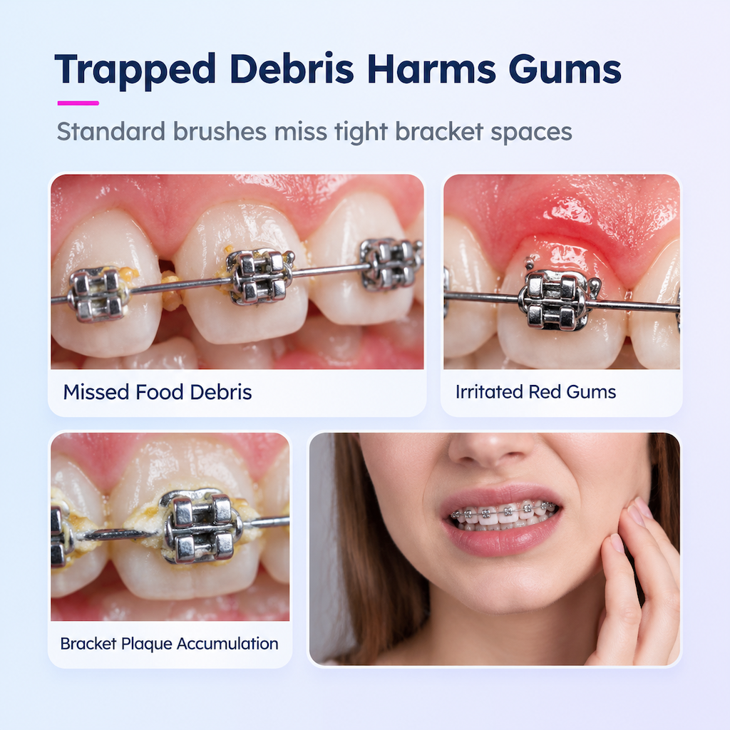 🦷Zahnzwischenraumbürste mit kleinem Bürstenkopf, zur Reinigung von Weisheitszähnen und Zahnzwischenräumen – 3-teiliges Set